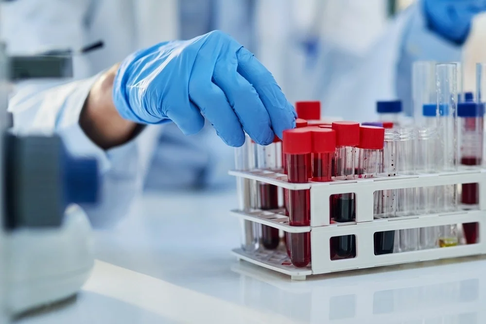 Lab Medicine- Pathology